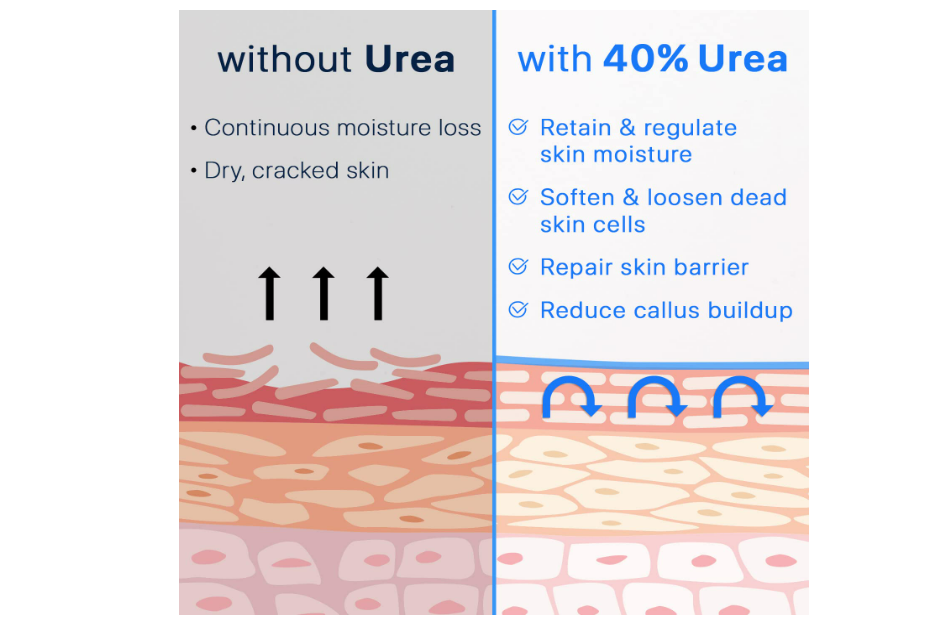 Ebanel Crema de urea 40% más ácido salicílico 2% - cuidado de la piel 130gr