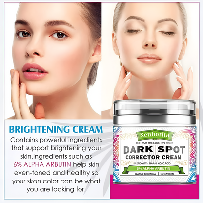 Senhorita - Crema correctora de manchas oscuras y decoloración, 1.7 oz (50ml)