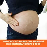 LOCION ANTIESTRIAS PALMERS  COCOA BUTTER FORMULA  315ml