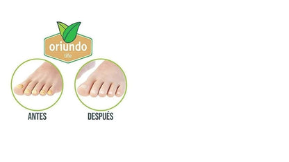 Oriundo Natural Life, Solución de tratamiento para uñas, 16ml