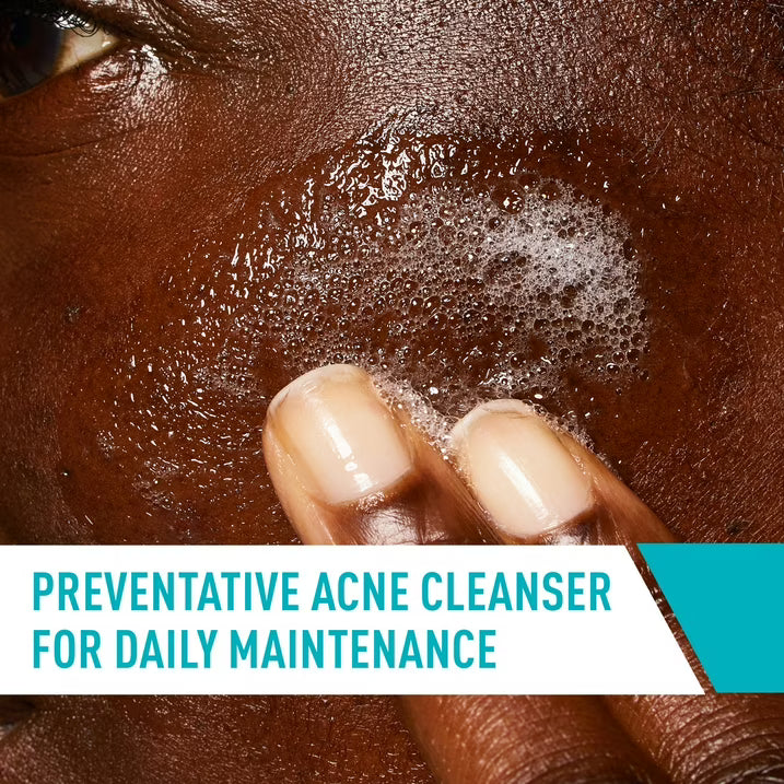 Limpiador facial para el control del acné de CeraVe Skin Care con ácido salicílico al 2%: elimina el acné, los puntos negros y los poros.