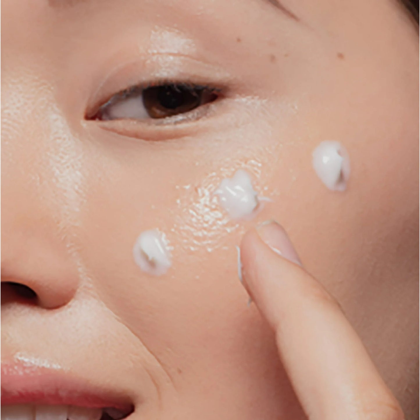 Tratamiento para el acné Neutrogena On-The-Spot con peróxido de benzoilo, 21g