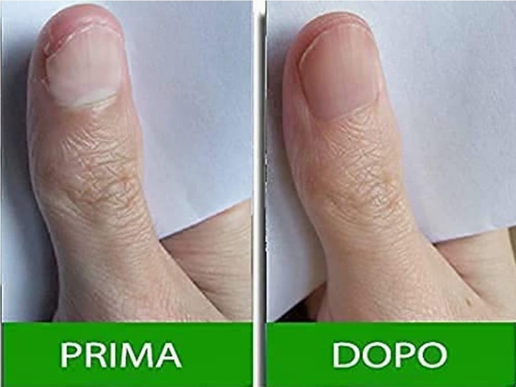 Pantogar Tratamiento Específico para Cabello y Uñas - 90 Capsulas