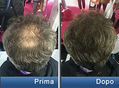 Pantogar Tratamiento Específico para Cabello y Uñas - 90 Capsulas