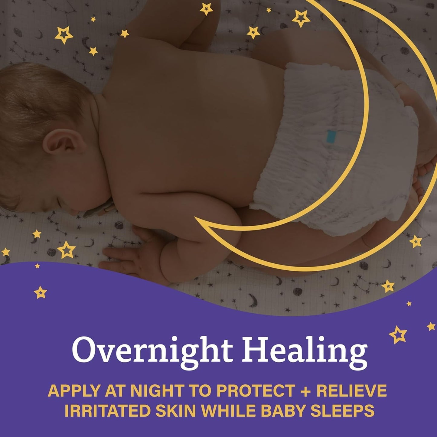 A+D Overnight Healing -  Crema  para la dermatitis del pañal de curacion Noctura - A+D para bebés, alivia, protege y cura durante la noche. 102 gr.