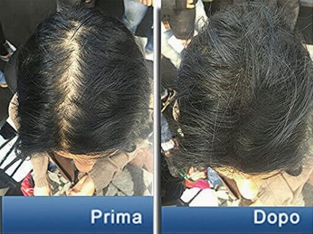 Pantogar Tratamiento Específico para Cabello y Uñas - 90 Capsulas