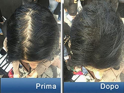 Pantogar Tratamiento Específico para Cabello y Uñas - 90 Capsulas