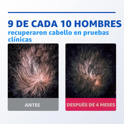 ROGAINE MEN ESPUMA - 60G - EVITA CAIDA DE CABELLO