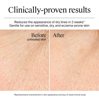 Neutrogena Hydro Boost - Crema de gel con ácido hialurónico, 50ml