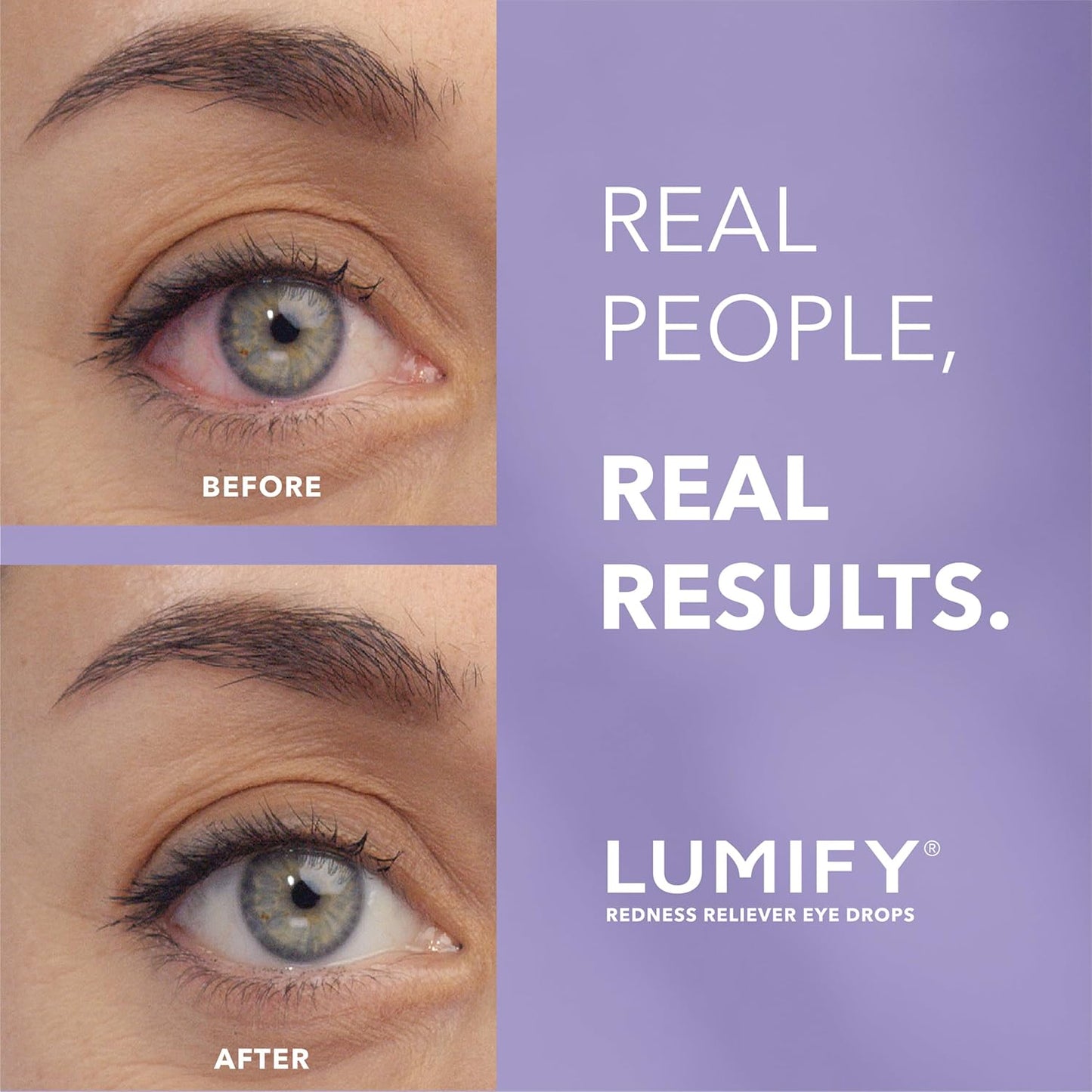 Bausch + Lomb - Lumify Gotas para los ojos para aliviar el enrojecimiento, 2.5ml