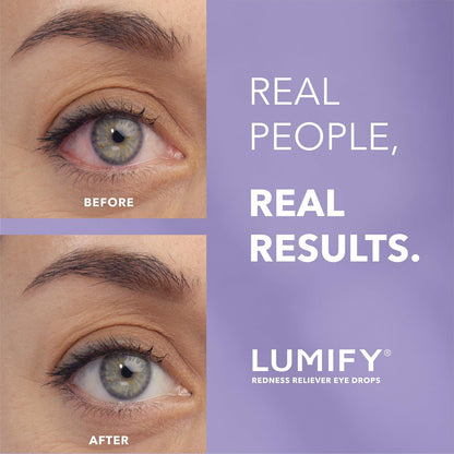 Bausch + Lomb - Lumify Gotas para los ojos para aliviar el enrojecimiento, 2.5ml