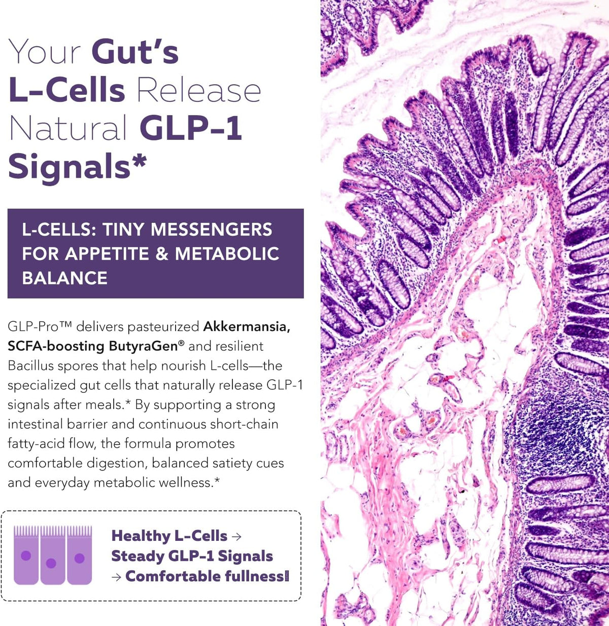 Triquetra, GLP-Pro: Mezcla de probióticos y postbióticos para el apoyo natural de GLP-1 — Akkermansia MucT, 30 capsulas
