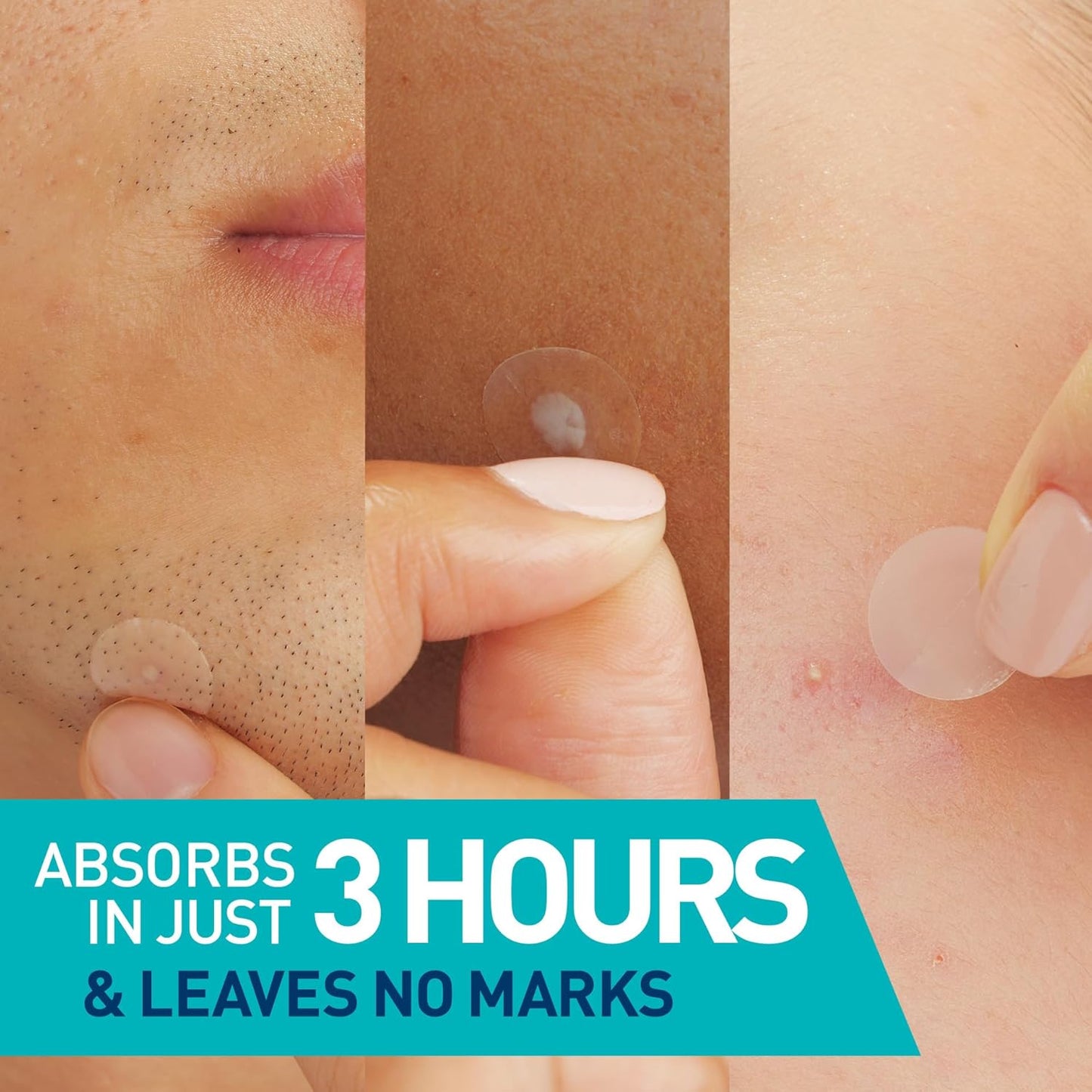 CeraVe - parches de barrera contra imperfecciones , 22 parches hidrocoloides invisibles (2 tamaños)