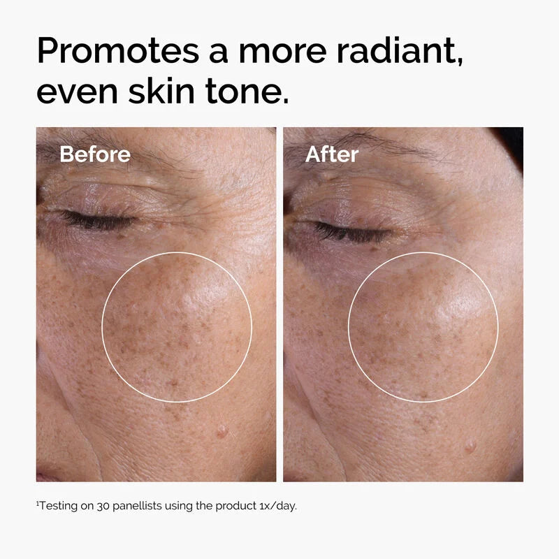 The Ordinary - Tónico exfoliante con ácido glicólico al 7%, 100ml