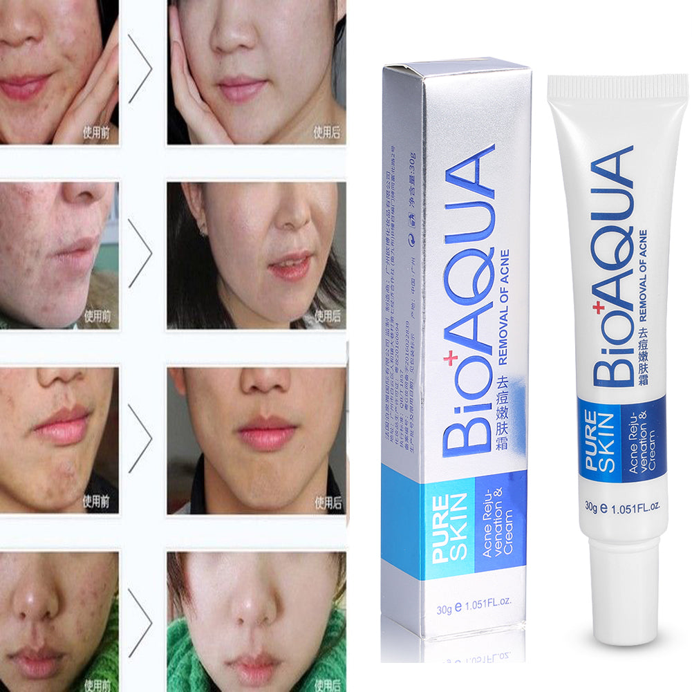 Bioaqua - Removedor De Acne - 30gr